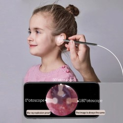 CAMÉRA ENDOSCOPIQUE AURICULAIRE USB